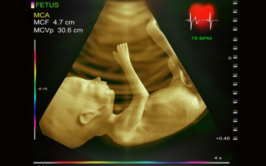 All you need to know about Fetal Echocardiography