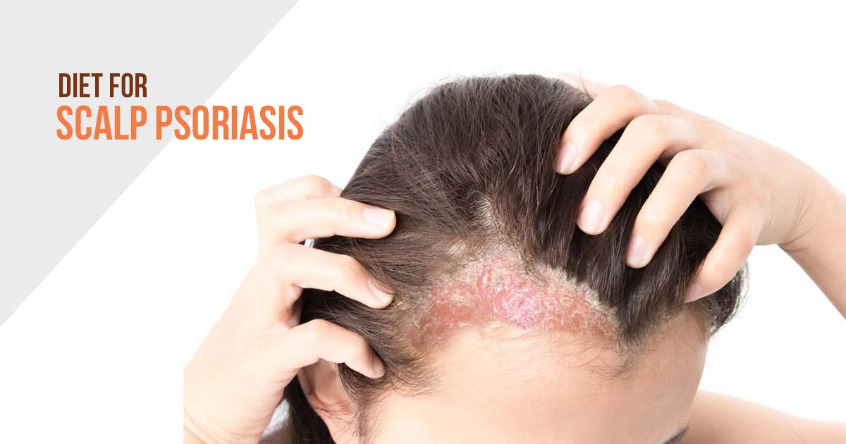 women affected by scalp psoriasis