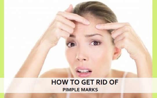 How to Get Rid of Pimples Marks
