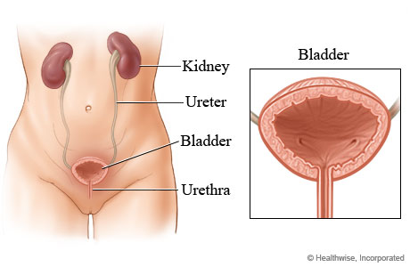 Doctor’s Advice on How to avoid Recurrent Urinary Tract Infections